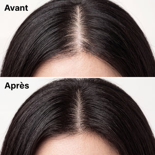 Shampoing coréen Yoracare