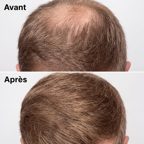 Shampoing coréen Yoracare